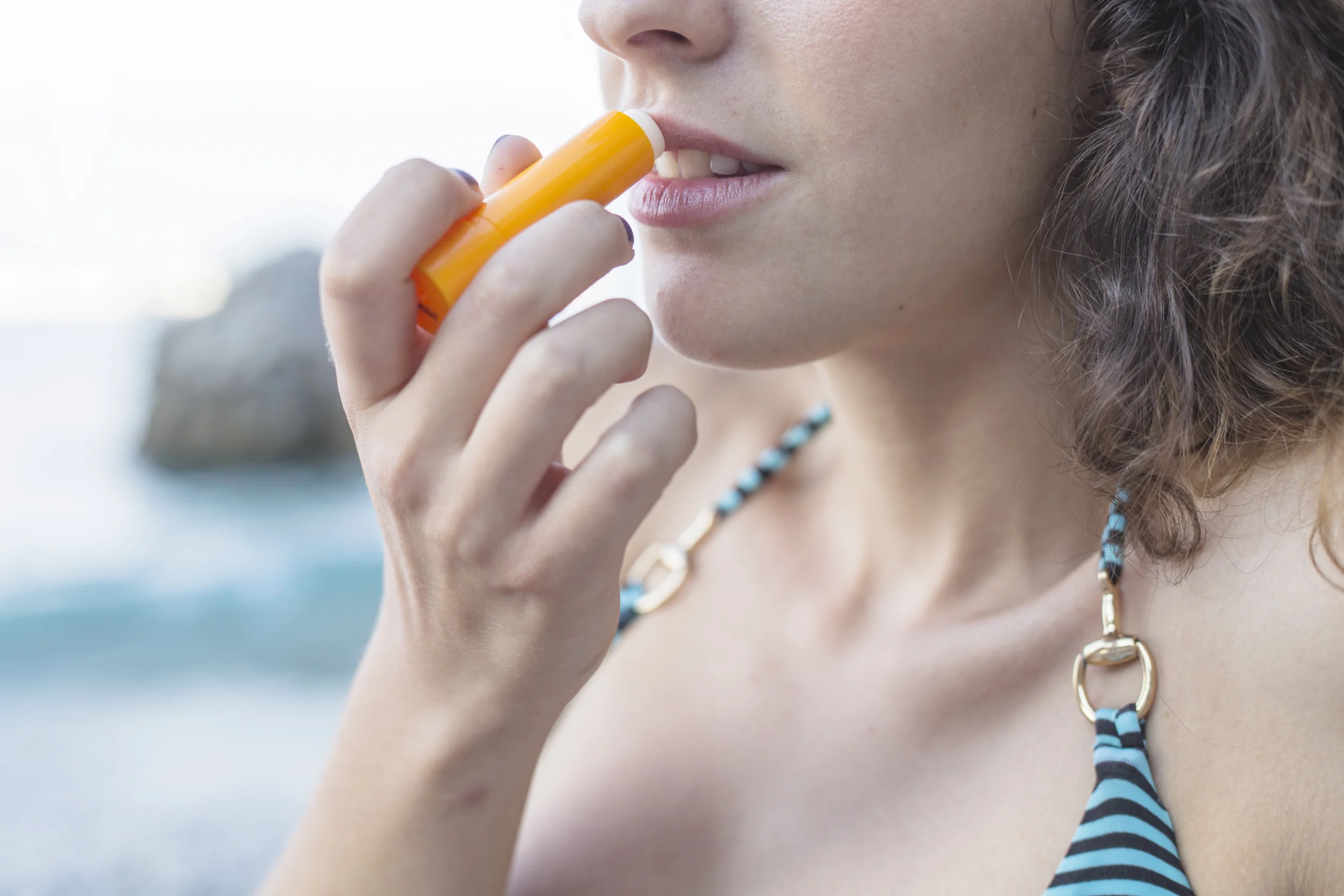 sunburn lips remedy